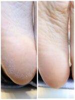 waiolinails foot footcare